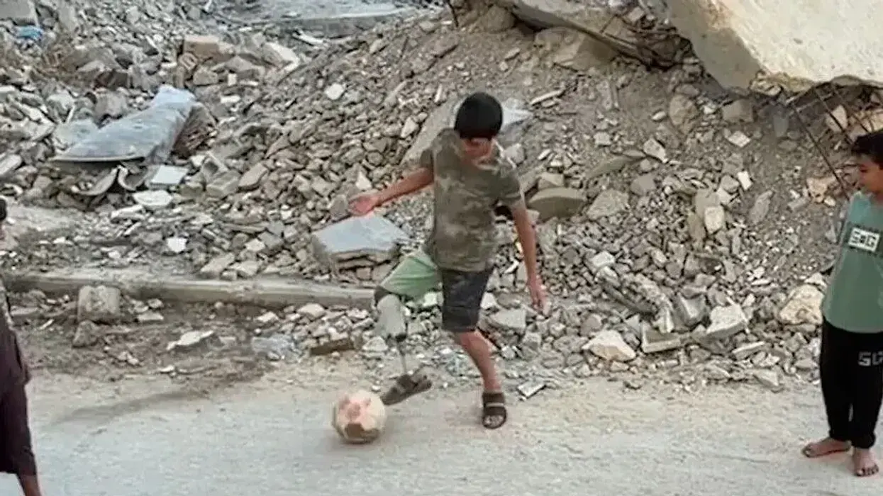 Humbi këmbën në sulm, 13-vjeçari nga Palestina vazhdon të luajë futboll me protezë